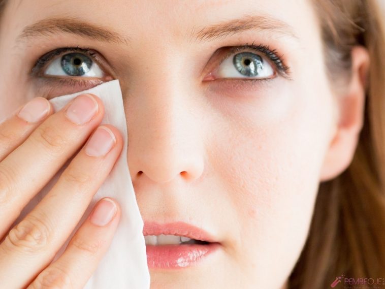 What is conjunctivitis in winter?