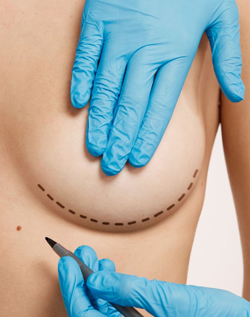 How is Male Breast Reduction Surgery Performed?