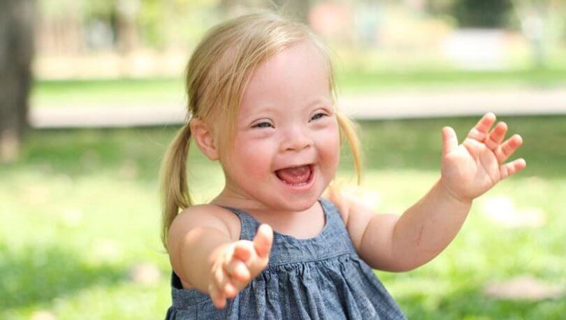 What is Down Syndrome?
