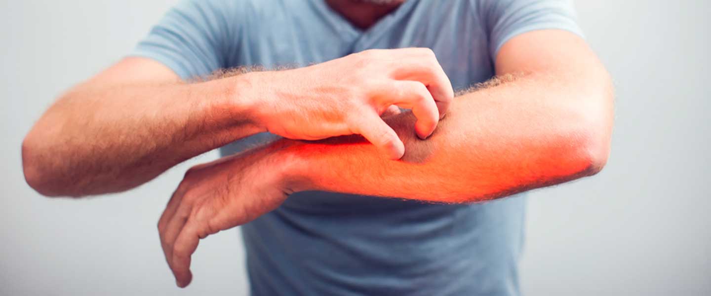 What is itching in the body?