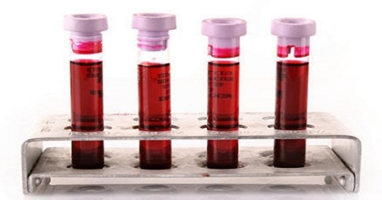 ​What is Sedimentation?