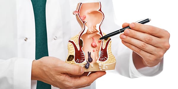 What is Hemorrhoids (Hemorrhoidal Disease)?