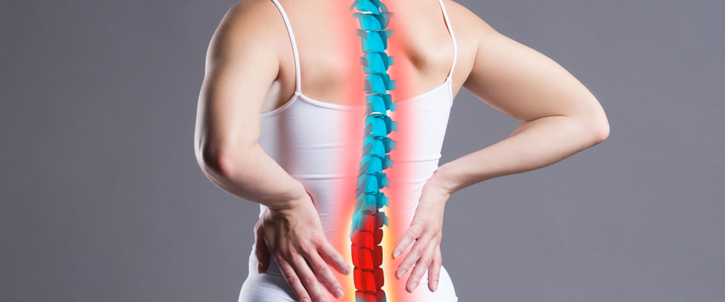 What is kyphosis?