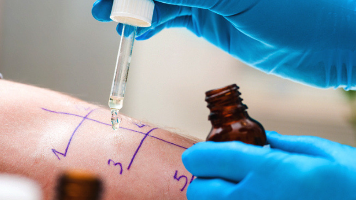 When Should I Get an Allergy Test?