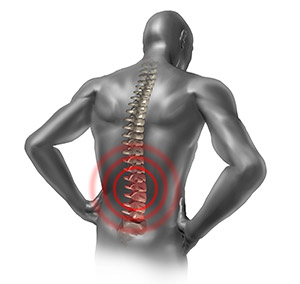 What should be considered in order to prevent lumbar hernia