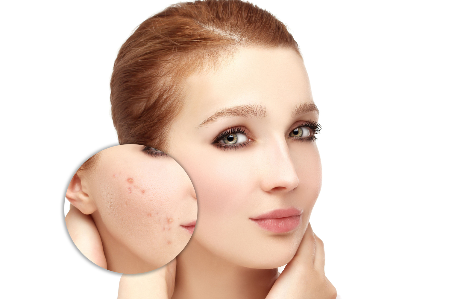 Skin spots caused by sun rays