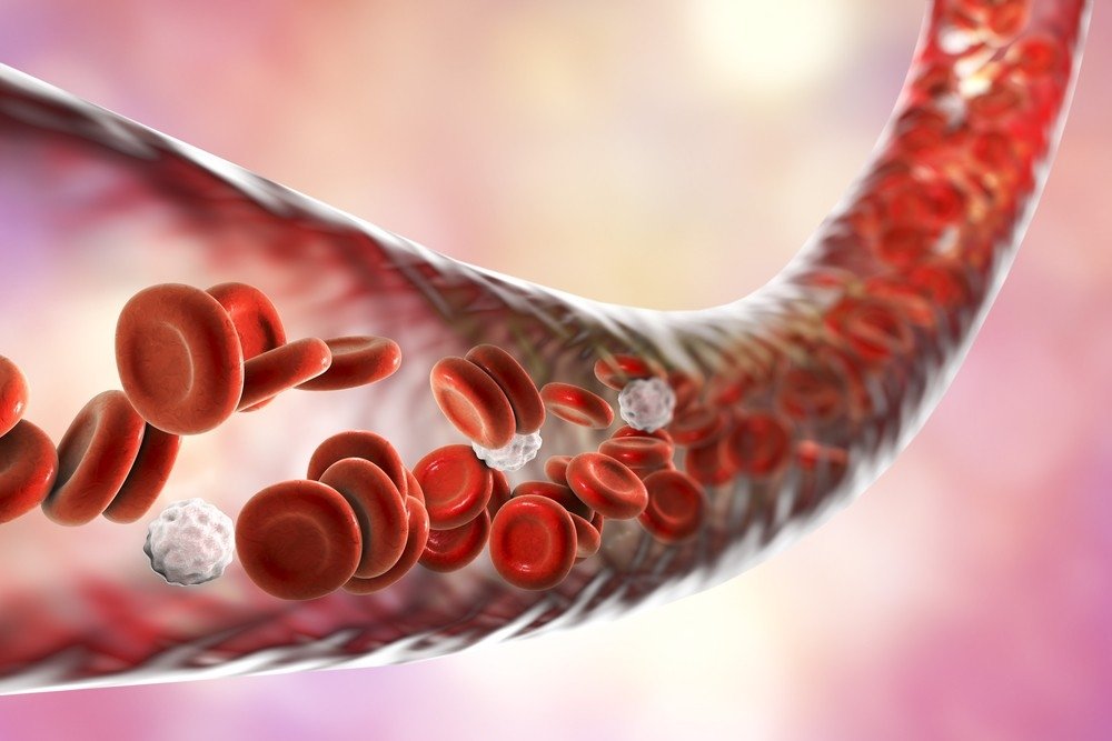 What is Vascular Occlusion