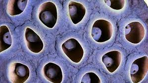 What is trypophobia?