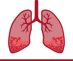 What Are the Triggers for Chocolate Allergy?