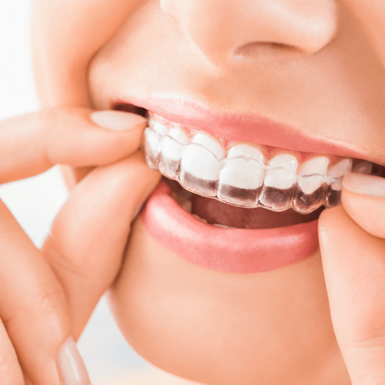 What Should Be Done Against Night Plaque