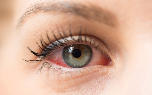 ​Eye Diseases That Occur With Age?