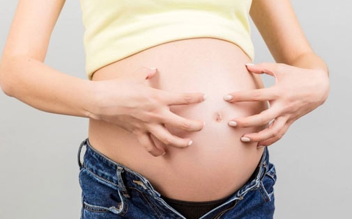 What is itching during pregnancy