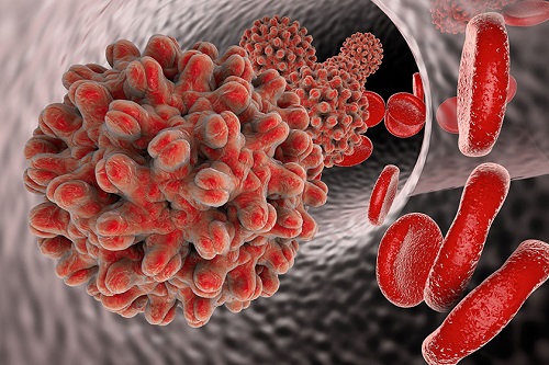 What is hepatitis b?