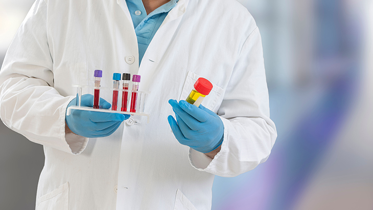 WHAT ARE THE CAUSES OF URINE BLEEDING?