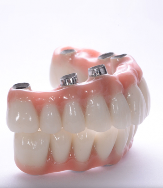 What are dental prostheses