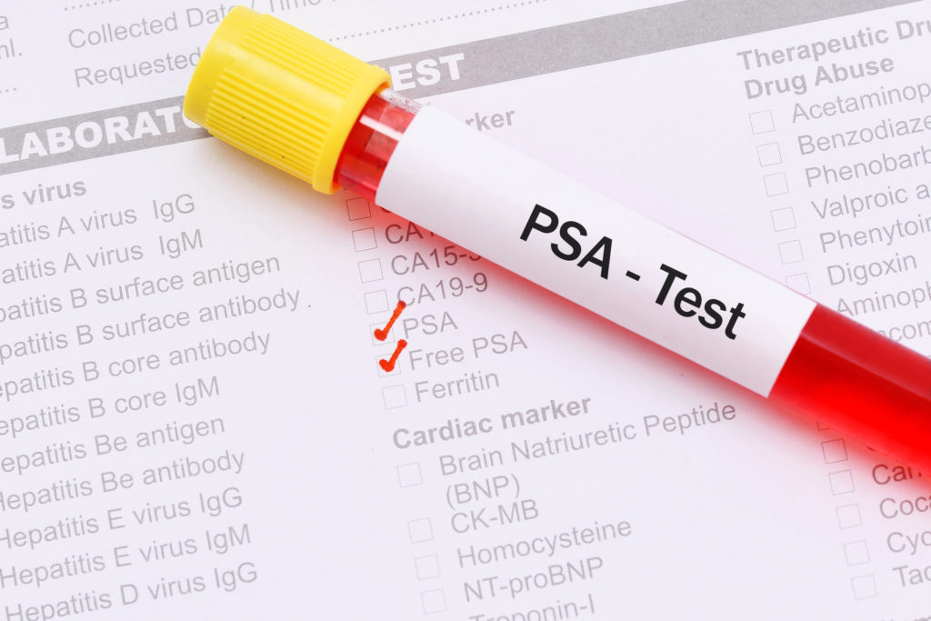 What is the PSA test?