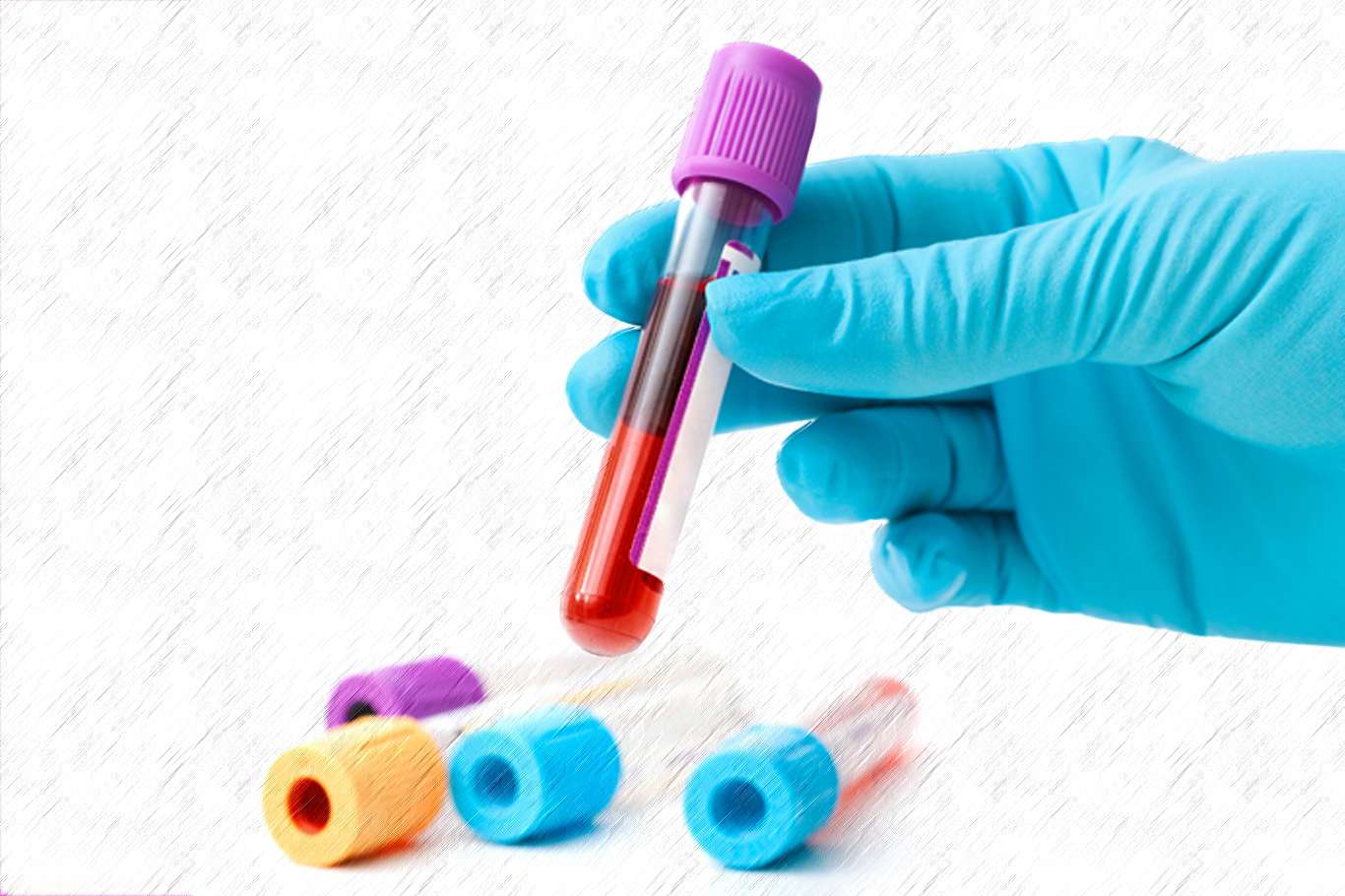 ​What are the symptoms of anemia?