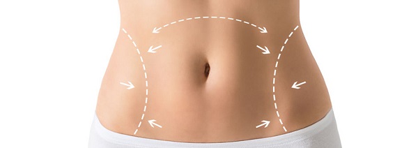 What is Tummy Tuck Aesthetics?