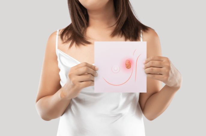 Major Symptoms in Breast Cancer