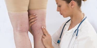 Treatment of lymphoma