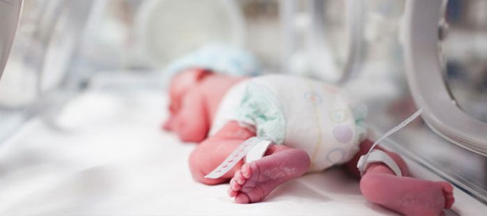 What is a premature baby ?
