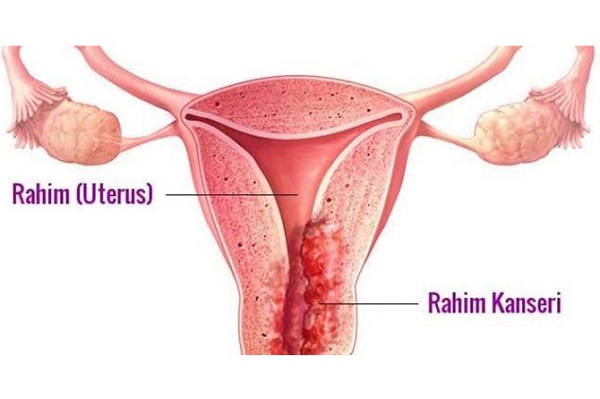 How does the HPV virus show symptoms?