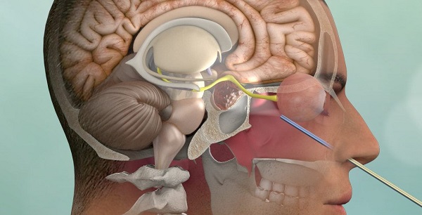 WHAT IS PİTUİTARY ADENOMAS
