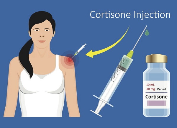 What is cortisone?