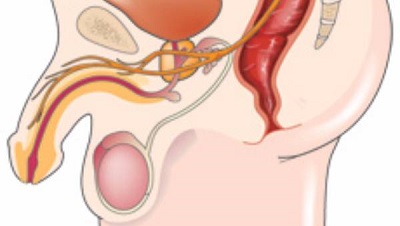 What are Testicular Diseases?