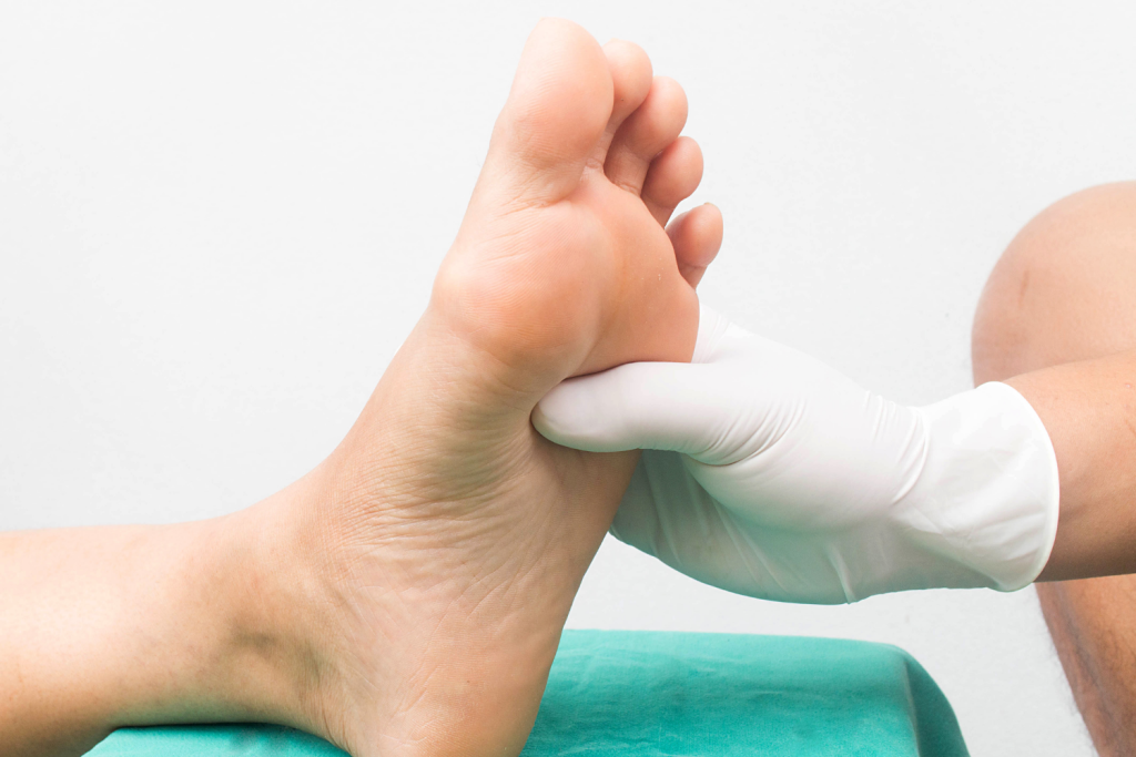 What are the Stages of Diabetic Foot?