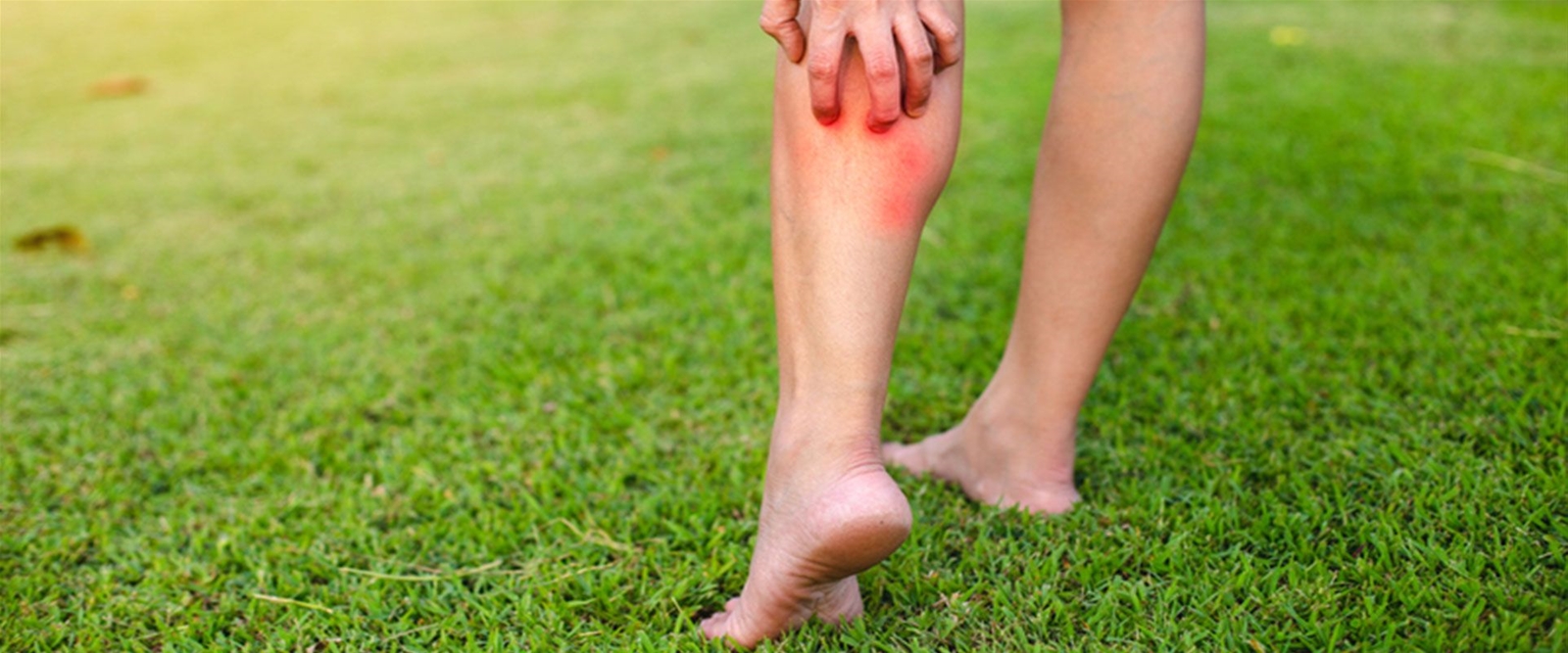 What is a Flea Bite?